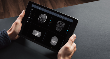 厚積薄發(fā) 匯醫(yī)慧影CCR2019三大產(chǎn)品線升級，構(gòu)建智慧影像全域生態(tài)